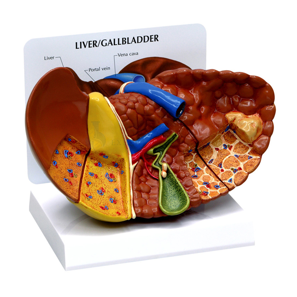 Pathological Model of The Human Liver