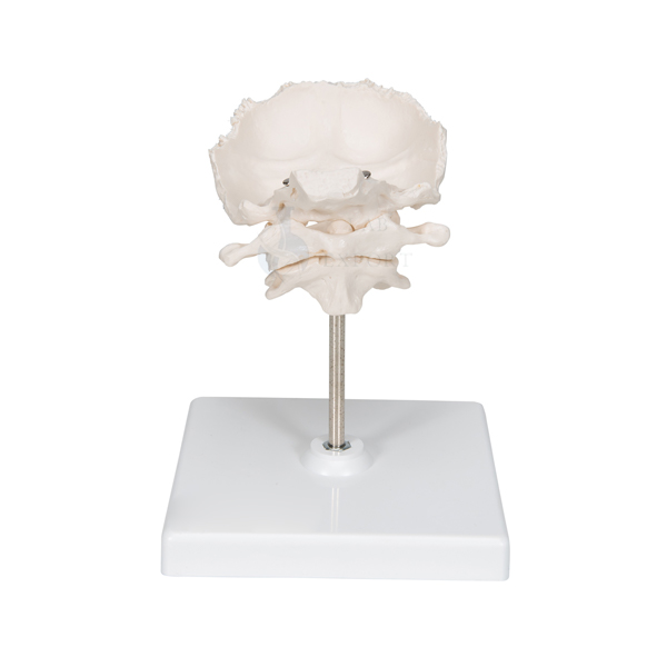 Atlas Axis and Occipital Bone Model