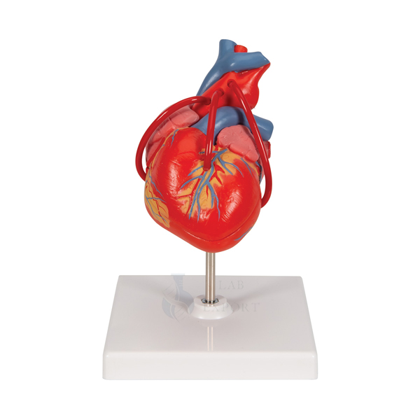 Heart with Bypass Model