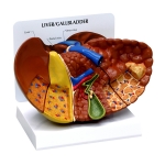 Pathological Model of The Human Liver