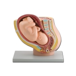 Pregnancy Pelvis with Mature Fetus