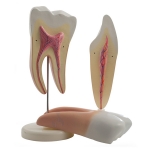 Molar and Incisor Cross Section Model